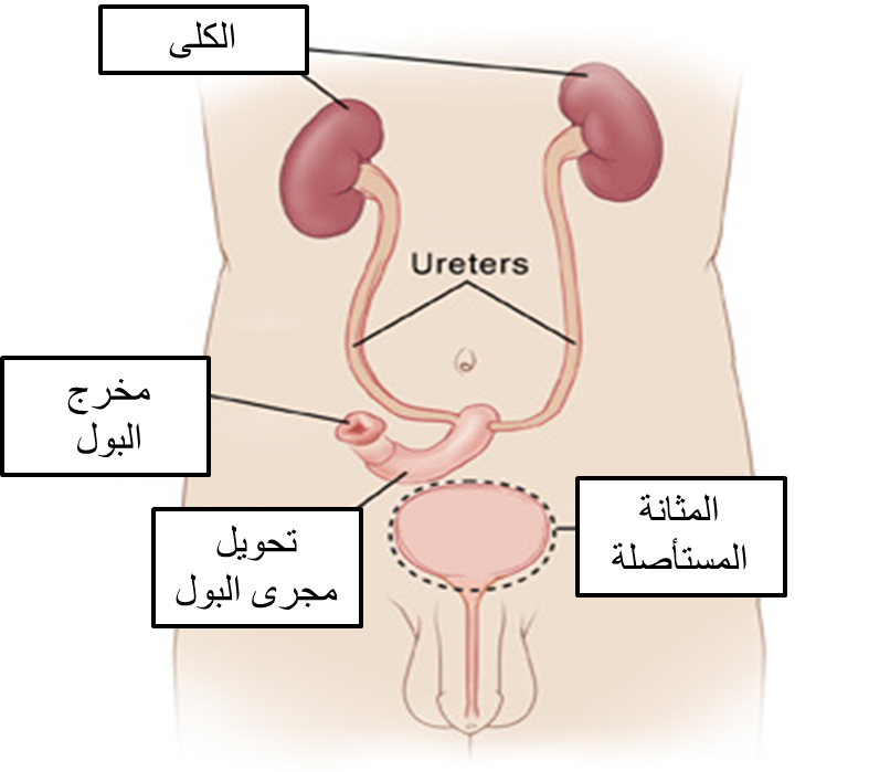 التهاب المثانة عند النساء اعراض التهاب المثانة